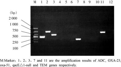 Detection and homology analysis of carbapenem resistant Acinetobacter baumannii resistance gene